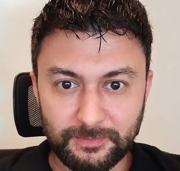 Saç ekimi: ön bölge yoğunluğu – Sonra